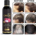 Hair Growth Oil